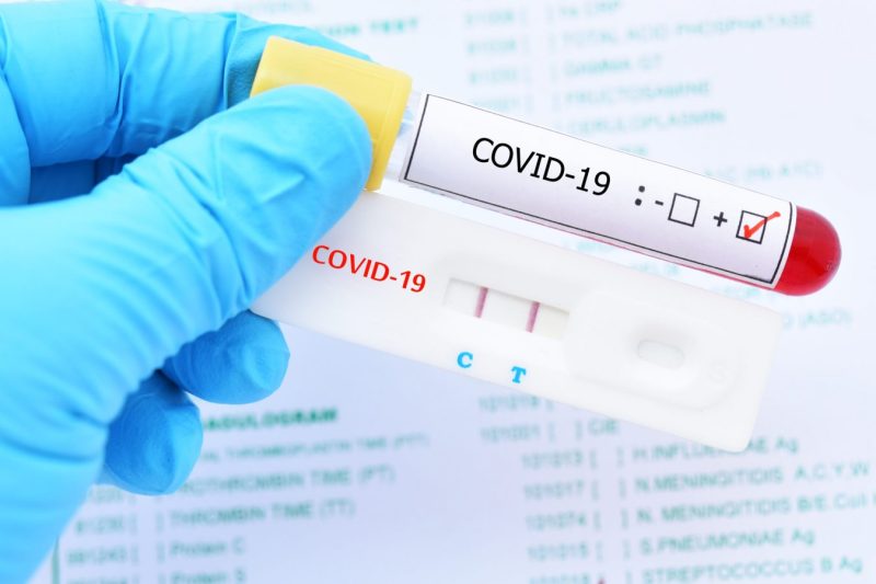 МОЗ підтвердило нові штами COVID-19